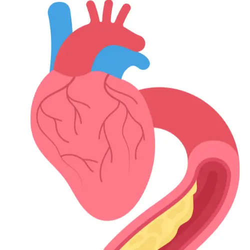 Stroke Interventions & Carotid Stenting